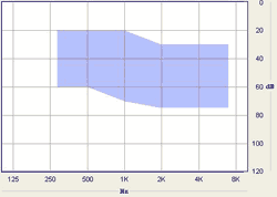 Hearing aid Metrix CIC