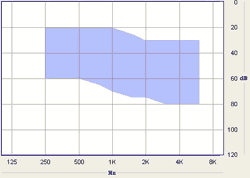 Hearing aid Metrix ITC