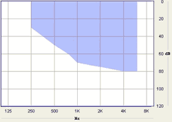 Hearing Aid PULSE BTE</h2>