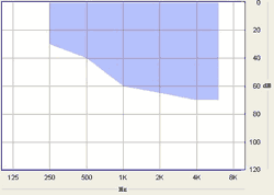 Hearing Aid ResoundAir