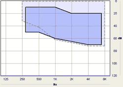 Hearing Aid Ziga